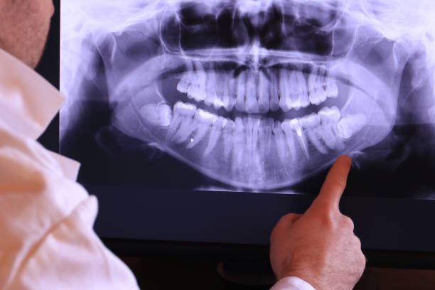 Best Broken or Cracked Tooth Emergency Dentist in Doffing, TX