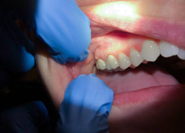 Best Pediatric Emergency Dentist in Doffing, TX